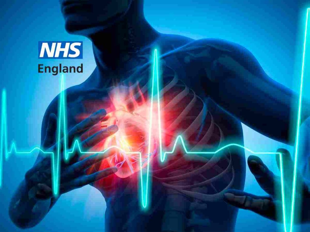 Read more about the article Cardiovascular disease prevention is failing the public says NAO