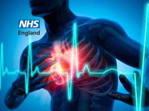 Read more about the article Cardiovascular disease prevention is failing the public says NAO